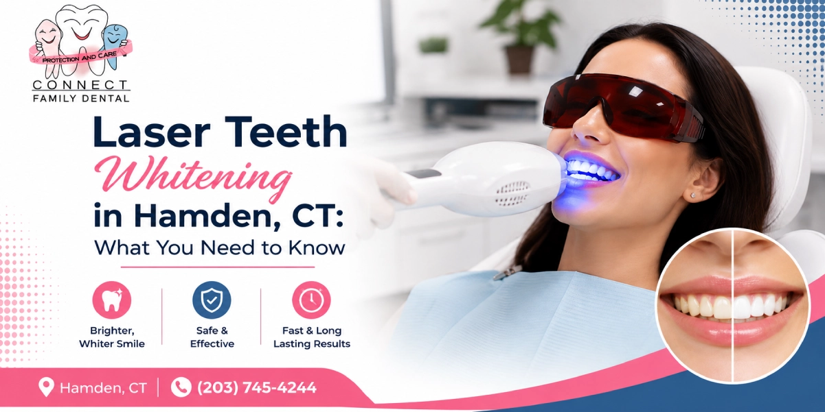 Laser Teeth Whitening in Hamden, CT: What You Need to Know