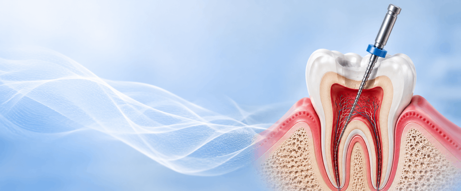 Root canal signs